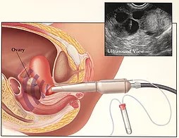 Dr Jephat Moyo | Bart Centre